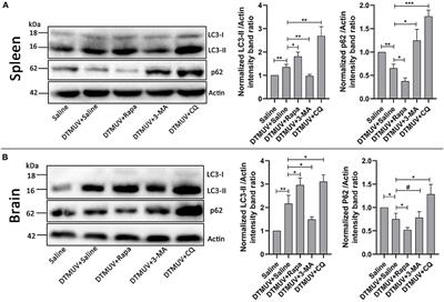 Autophagy Is a Potential Therapeutic Target Against Duck Tembusu Virus Infection in vivo